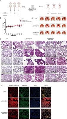 The lncRNA CADM2-AS1 promotes gastric cancer metastasis by binding with miR-5047 and activating NOTCH4 translation